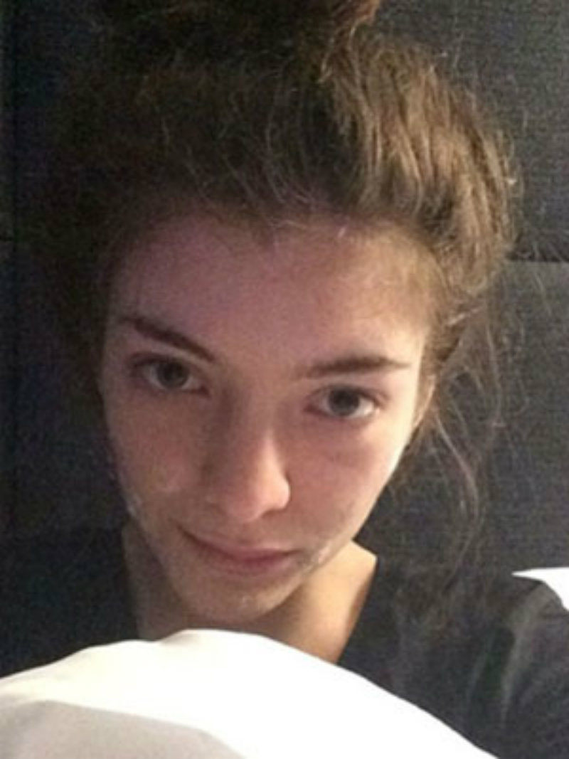 Lorde siempre apuesta por la belleza natural, y nada mejor que esta foto donde se muestra con su crema para el acné. 